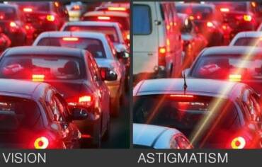 Astigmatismus (cylindrická oční vada)